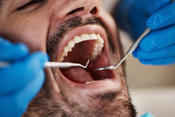 Best Emergency Care for Gum Disease in Eudora, KS